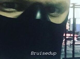 Bruisedup